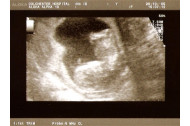Specjalizacja Pielęgniarstwo neonatologiczne